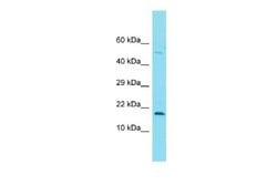 FOXL2NB Rabbit anti-Human, Polyclonal, Novus Biologicals 0.1 mL | Buy Online | Novus Biologicals | Fisher Scientific